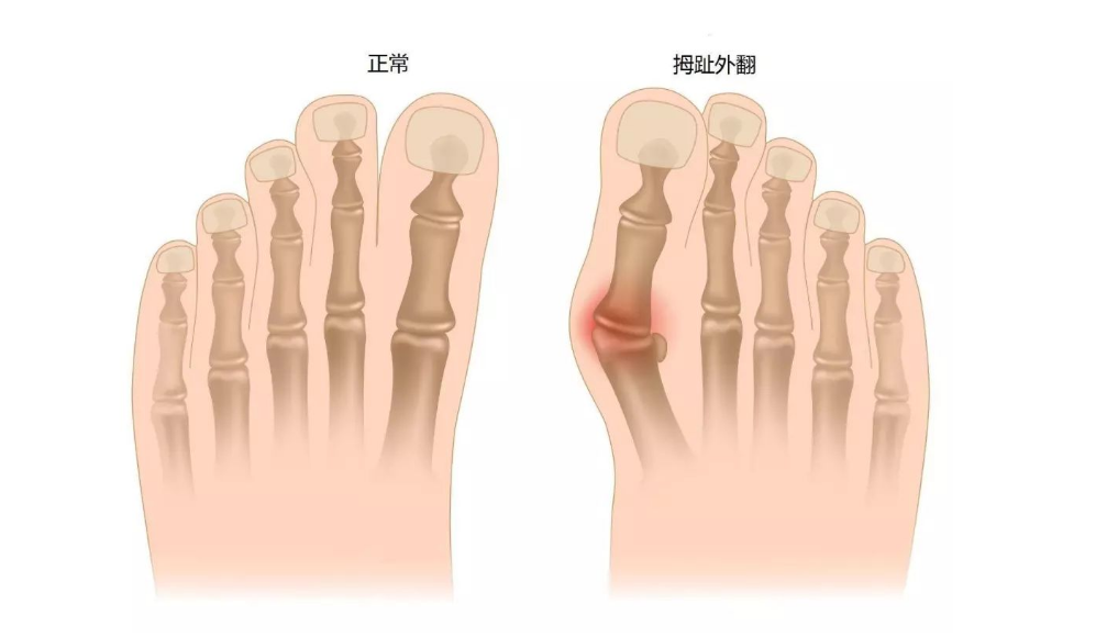 小儿夜间咳嗽按脚部哪个穴位_脚部穴位图_脚部穴位图解大全