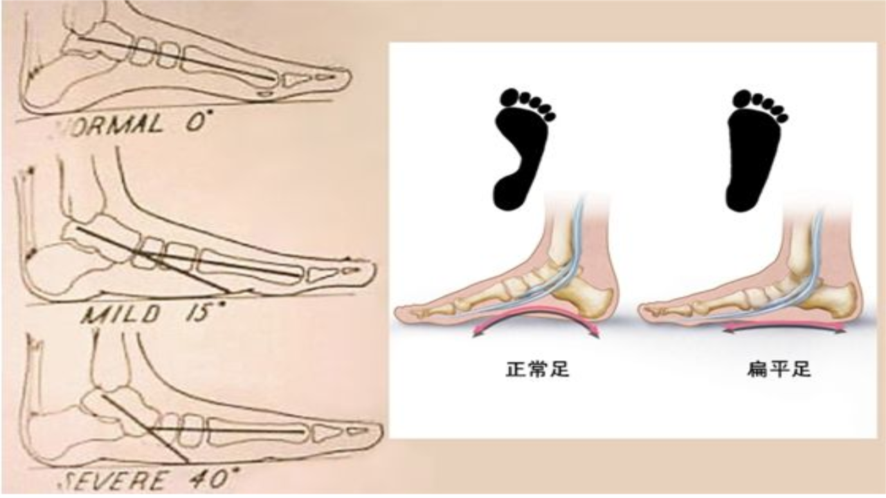 小儿夜间咳嗽按脚部哪个穴位_脚部穴位图解大全_脚部穴位图