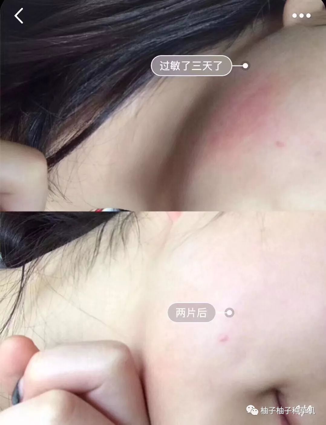 敷完面膜洗脸之后用涂护肤品么_敷面膜后洗完脸还要涂水和乳吗_敷尔佳面膜用完要洗吗