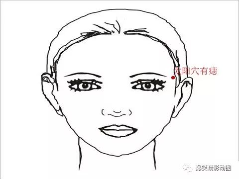 右眉头有痣的女人命运_右眉眉头有痣的女人好不好_眉头右边有痣的女人