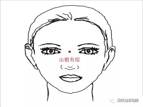 右眉头有痣的女人命运_眉头右边有痣的女人_右眉眉头有痣的女人好不好