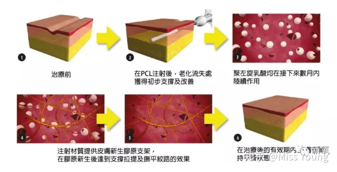 蛋白针有用吗_打蛋白针有什么作用_蛋白针有副作用吗