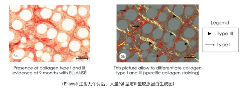 打蛋白针有什么作用_蛋白针有副作用吗_蛋白针有用吗