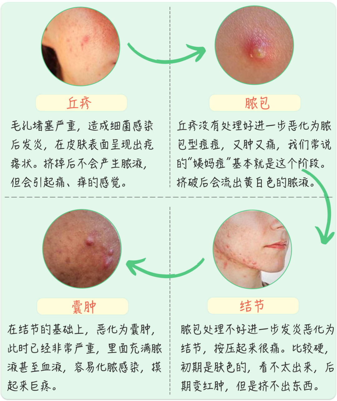 角质硬化症图片_角质硬化症图片_角质硬化症图片