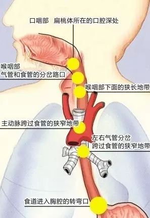 小鱼刺喉咙_小鱼刺卡喉咙一招搞定_小鱼鱼刺卡喉咙怎么办