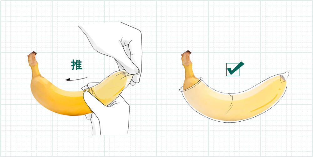 玻尿酸套和普通套区别_玻尿酸套与普通套哪个舒服_玻尿酸安全套和普通的有什么区别