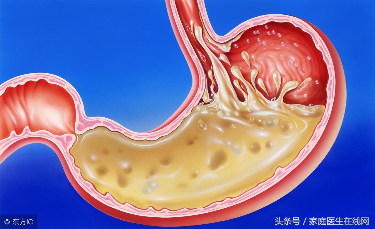 胃动力足吃什么药_怎样彻底治疗胃动力足_胃动力不足怎么调理