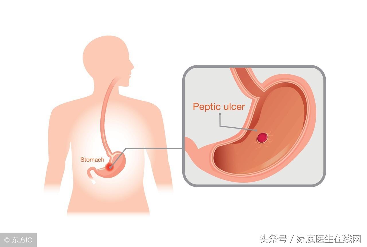 胃动力足吃什么药_胃动力不足怎么调理_怎样彻底治疗胃动力足